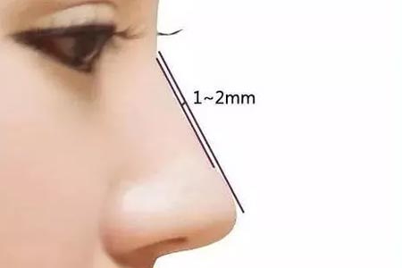 自体软骨隆鼻手术都有哪些优点