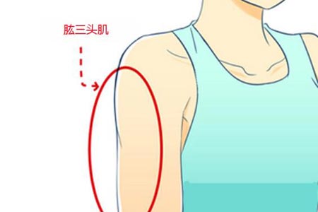 手臂抽脂术后需要多久才能恢复自然