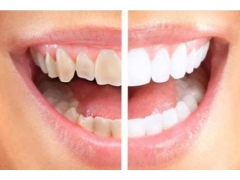 牙齿黄什么方法可以让牙齿变得白啊
