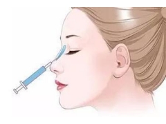 注射隆鼻后还能做假体隆鼻手术吗