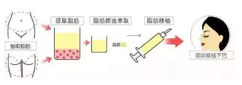 哪些方法能让我获得漂亮下巴？