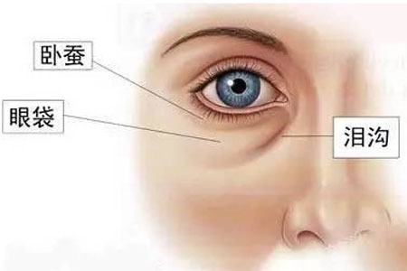 在上海做韩式祛眼袋手术的风险大不大