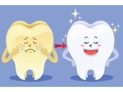什么方法可以将牙齿变白