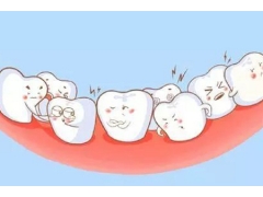 牙齿矫正需要多久,矫正真的有吗