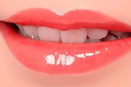 冷光美白牙齿有效吗，能维持多久