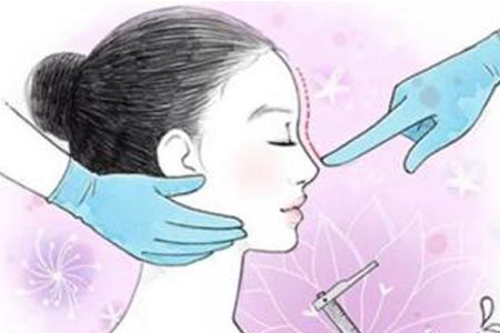 韩式隆鼻整形术后可以冰敷消肿吗