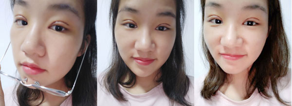 <a href='/' target='_blank'><u>上海美莱</u></a>双眼皮案例