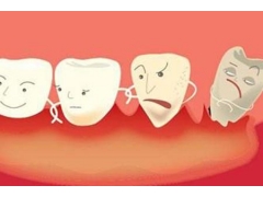 牙齿矫正用什么方法比较好