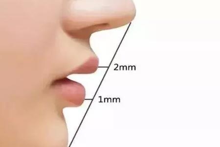 做完假体隆鼻整形手术后注意事项有哪些