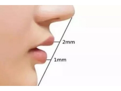 做完假体隆鼻整形手术后注意事项有哪些