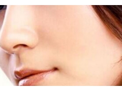假体隆鼻术后的淤青多久会消除