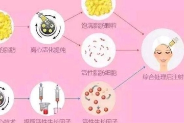 做完面部脂肪填充塑形半年后会下垂吗？