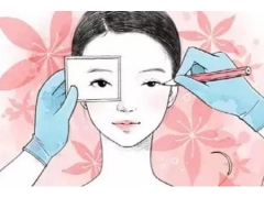 做完双眼皮手术后怎么才能快速消肿