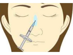 注射玻尿酸隆鼻手术有哪些优势