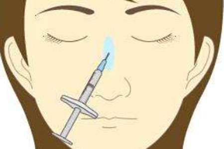 注射玻尿酸隆鼻有哪些优点