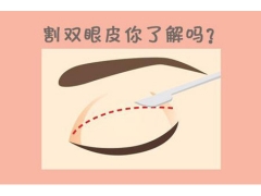 上海做双眼皮需要多少钱，会不会特别贵