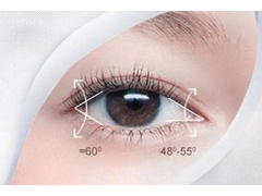 开眼角手术可以让小眼睛变大吗