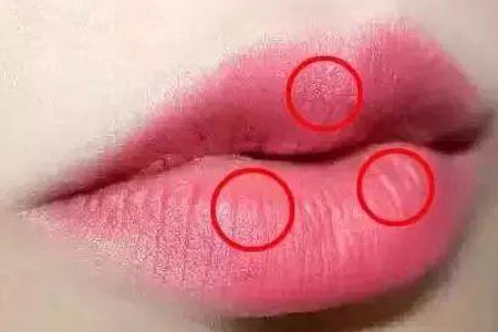 唇部比较薄什么方法可以有效的丰唇