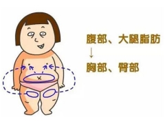 自体脂肪填充丰胸价格贵不贵,隆胸安全吗
