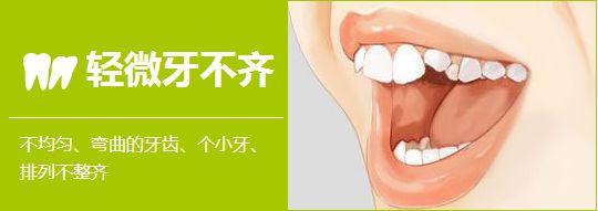 上海美莱牙齿美白的手段——皓齿美白