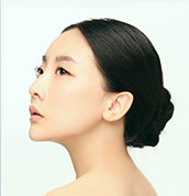 美莱案例陈嘉歆术后90°