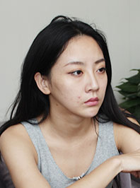 美莱案例陈嘉歆手术起天