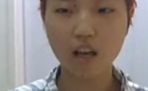 美莱案例黄思斓整形现场