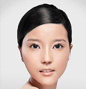 美莱案例黄思斓术后0°