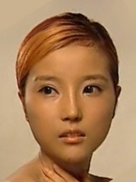 美莱案例黄思斓术后素颜