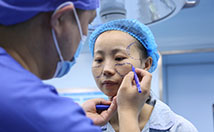 美莱案例孟梦整形现场