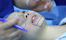 美莱案例孟梦整形现场