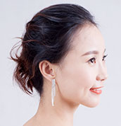 美莱案例孟梦术后90°