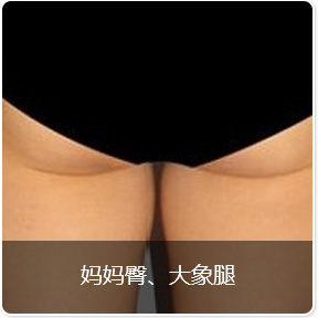 妈妈臀大象腿