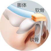 植入鼻部