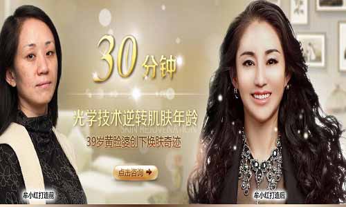 Menry专题_真人秀案例