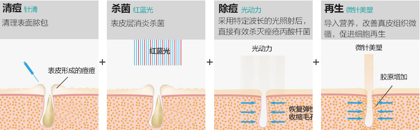 LED红蓝光杀菌消炎